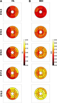 Detailed quantification of cardiac ventricular myocardial architecture in the embryonic and fetal mouse heart by application of structure tensor analysis to high resolution episcopic microscopic data